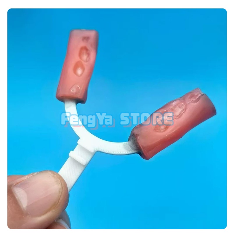10Pcs/Bag Orthodontic Mandibul - 3D Printing Orthodontics 评论和价格