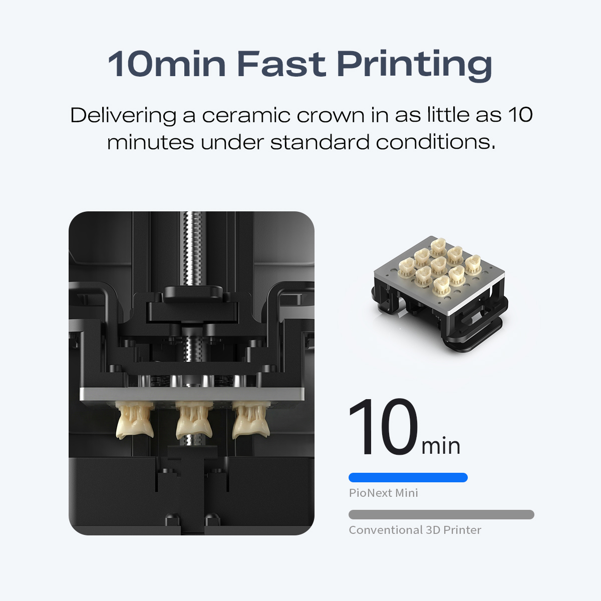 Mini High-precision Dental 3d  - 3D Printing Orthodontics 评论和价格