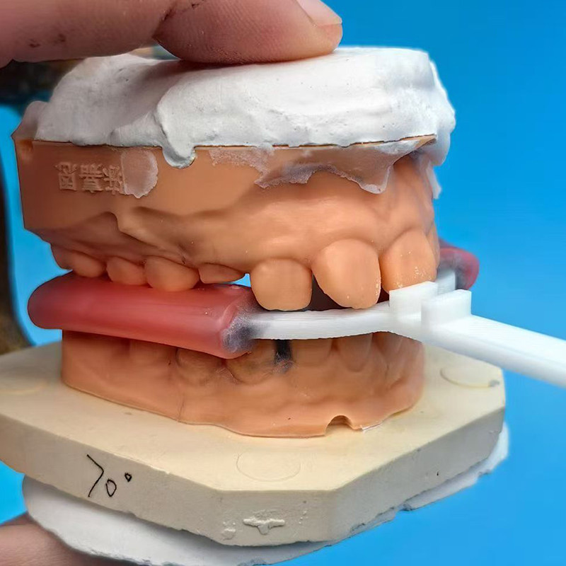 10Pcs/Bag Dental Bite Fork Ort - 3D Printing Orthodontics 评论和价格
